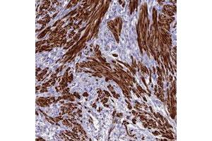 Immunohistochemical staining of human smooth muscle with CLIP4 polyclonal antibody  shows strong cytoplasmic positivity in smooth muscle cells at 1:20-1:50 dilution. (CLIP4 antibody)