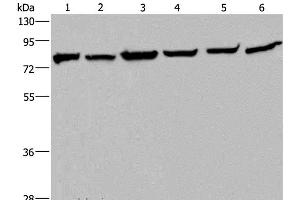 Western Blot analysis of Mouse kidney tissue, HT-29, A549, 293T, MCF-7 and Hela cell using HSPA9 Polyclonal Antibody at dilution of 1:400 (HSPA9 antibody)