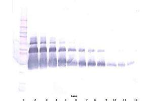 Image no. 1 for anti-Vascular Endothelial Growth Factor A (VEGFA) antibody (Biotin) (ABIN465275) (VEGFA antibody  (Biotin))