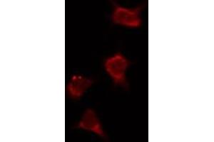 ABIN6274036 staining Hela by IF/ICC. (PIK3R2 antibody  (C-Term))