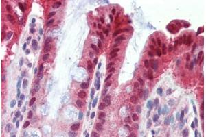 Immunohistochemistry (Paraffin-embedded Sections) (IHC (p)) image for anti-Nuclear Receptor Subfamily 1, Group I, Member 3 (NR1I3) (AA 180-229) antibody (ABIN462245)