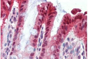 Human Colon (formalin-fixed, paraffin-embedded) stained with NR1I3 antibody ABIN462245 followed by biotinylated goat anti-rabbit IgG secondary antibody ABIN481713, alkaline phosphatase-streptavidin and chromogen. (NR1I3 antibody  (AA 180-229))