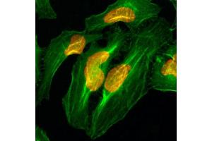 Immunocytochemistry staining of HeLa cells with Histone H2A monoclonal antibody, clone RM225  (Red).