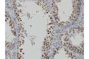Immunoperoxidase of monoclonal antibody to DDX26 on formalin-fixed paraffin-embedded human testis.