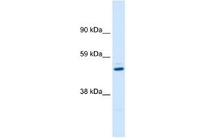 KCNAB1 antibody used at 1 ug/ml to detect target protein. (KCNAB1 antibody  (C-Term))