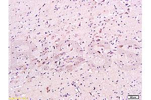 Formalin-fixed and paraffin embedded mouse brain tissue labeled with Anti-CHRNA7 Polyclonal Antibody, Unconjugated (ABIN736911) at 1:200, followed by conjugation to the secondary antibody and DAB staining