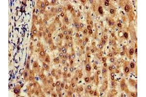 Immunohistochemistry of paraffin-embedded human liver tissue using ABIN7162155 at dilution of 1:100