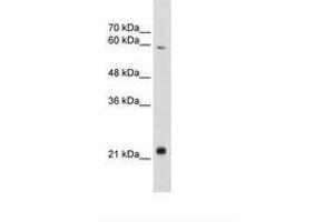 Image no. 1 for anti-Recombination Signal Binding Protein For Immunoglobulin kappa J Region-Like (RBPJL) (AA 110-159) antibody (ABIN203286) (RBPJL antibody  (AA 110-159))