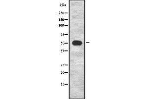 Western blot analysis of PCYOX1 using Jurkat whole cell lysates (PCYOX1 antibody  (Internal Region))