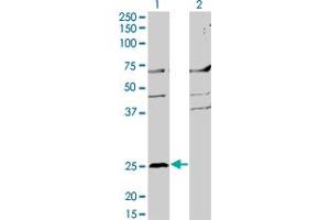 Western Blot analysis of MS4A2 expression in transfected 293T cell line by MS4A2 monoclonal antibody (M02), clone 3B1. (MS4A2 antibody  (AA 1-59))