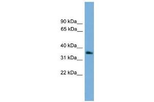GNB4 antibody used at 0. (GNB4 antibody  (Middle Region))