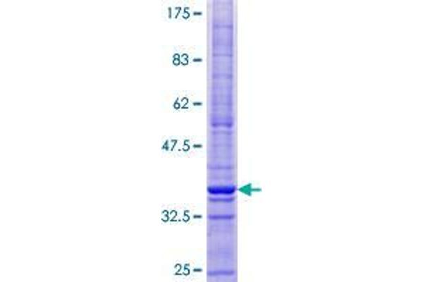 CMTM1 Protein (AA 1-114) (GST tag)