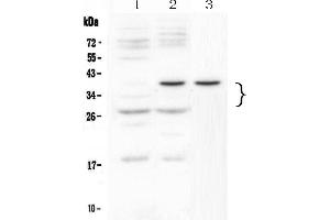 Western blot analysis of VEGF using anti-VEGF antibody . (VEGFA antibody  (AA 27-190))