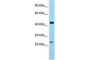 Image no. 1 for anti-Abhydrolase Domain Containing 12 (ABHD12) (C-Term) antibody (ABIN6748336) (ABHD12 antibody  (C-Term))