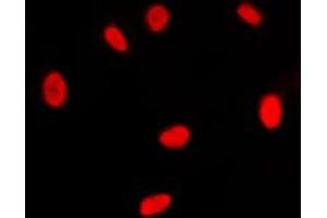 Immunofluorescent analysis of RXR gamma staining in NIH3T3 cells. (Retinoid X Receptor gamma antibody  (Center))