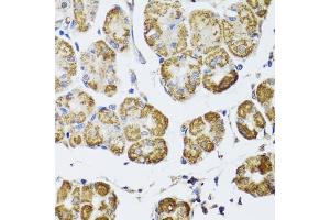 Immunohistochemistry (IHC) image for anti-Histone Deacetylase 6 (HDAC6) (AA 1-200) antibody (ABIN3022457)