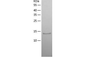 Vascular Endothelial Growth Factor A (VEGFA) (AA 27-146) protein (His-IF2DI Tag)
