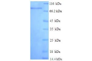 SDS-PAGE (SDS) image for Interferon-Induced Protein with Tetratricopeptide Repeats 3 (IFIT3) (AA 1-490), (full length) protein (His-SUMO Tag) (ABIN5709709) (IFIT3 Protein (AA 1-490, full length) (His-SUMO Tag))