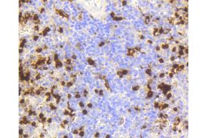Immunohistochemistry of paraffin-embedded human spleen using LYZ antibody. (LYZ antibody)