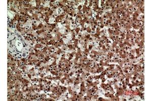 Immunohistochemistry (IHC) analysis of paraffin-embedded Human Liver, antibody was diluted at 1:100. (STX1A antibody  (Internal Region))
