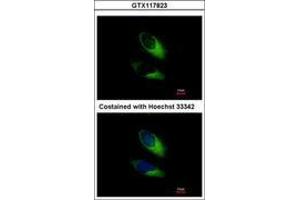 Image no. 3 for anti-Synaptosomal-Associated Protein, 23kDa (SNAP23) (AA 6-211) antibody (ABIN1501021) (SNAP23 antibody  (AA 6-211))