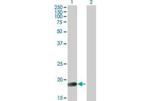 Western Blot analysis of GLYAT expression in transfected 293T cell line by GLYAT MaxPab polyclonal antibody.
