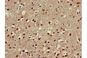 Immunohistochemistry of paraffin-embedded human brain tissue using ABIN7152527 at dilution of 1:100 (FOXRED2 antibody  (AA 501-684))