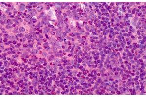 Human Tonsil: Formalin-Fixed, Paraffin-Embedded (FFPE) (TK1 antibody  (N-Term))