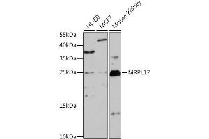 Western blot analysis of extracts of various cell lines, using MRPL17 antibody (ABIN7268559) at 1:1000 dilution. (MRPL17 antibody  (AA 86-175))