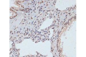 Immunohistochemistry of paraffin-embedded Rat lung using Phospho-ERK1(T202/Y204)/ ERK2(T185/Y187) Polyclonal Antibody at dilution of 1:100 (40x lens). (ERK1 antibody  (pThr185, pThr202, pTyr187, pTyr204))