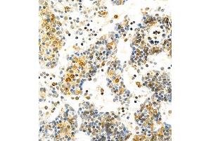 Immunohistochemistry (Paraffin-embedded Sections) (IHC (p)) image for anti-HLA-DR-gamma (CD74) antibody (ABIN7074245)