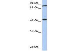 Image no. 1 for anti-Testis Expressed 9 (TEX9) (AA 287-336) antibody (ABIN6743917) (TEX9 antibody  (AA 287-336))