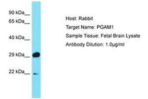 Image no. 1 for anti-phosphoglycerate Mutase 1 (Brain) (PGAM1) (C-Term) antibody (ABIN6750470) (PGAM1 antibody  (C-Term))