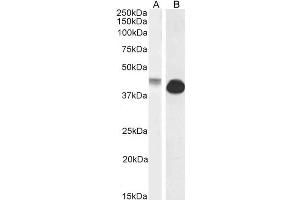 ABIN570972 (0. (Connexin 43/GJA1 antibody  (Internal Region))