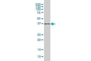 AKR1B10 monoclonal antibody (M01), clone 1A6 Western Blot analysis of AKR1B10 expression in HepG2 . (AKR1B10 antibody  (AA 76-143))