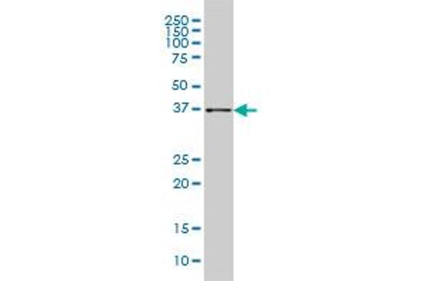 AKR1B10 antibody  (AA 76-143)