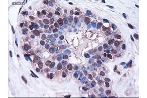 Immunohistochemical staining of paraffin-embedded breast using anti-HES1 (TA000114) mouse monoclonal antibody. (HES1 antibody  (AA 1-280))