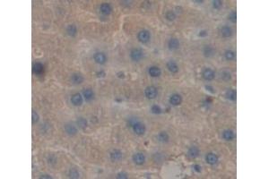 IHC-P analysis of Rat Tissue, with DAB staining. (Prothrombin antibody  (AA 44-200))