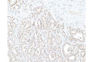 Immunohistochemistry (IHC) image for anti-Denticleless E3 Ubiquitin Protein Ligase Homolog (DTL) (C-Term) antibody (ABIN7454696)