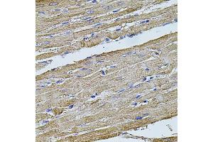 Immunohistochemistry of paraffin-embedded rat heart using FLNB antibody. (FLNB antibody)