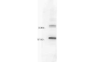 Anti IL-10 whole antiserum  was tested against recombinant IL10. (IL-10 antibody)