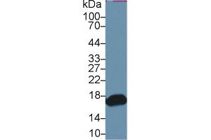 Western Blot; Sample: Mouse Small intestine lysate; Primary Ab: Rabbit Anti-Human RBP2 Antibody Second Ab: 0. (RBP2 antibody  (AA 1-134))