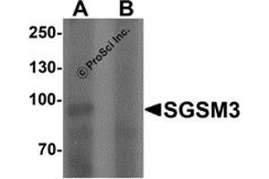 Western Blotting (WB) image for anti-Small G Protein Signaling Modulator 3 (SGSM3) (N-Term) antibody (ABIN1077375)