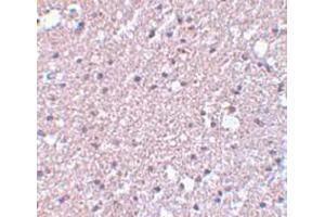 Immunohistochemistry staining of human brain tissue (Paraffin section) with TMEM184A Antibody   at 5 μg/ml. (TMEM184A antibody  (C-Term))