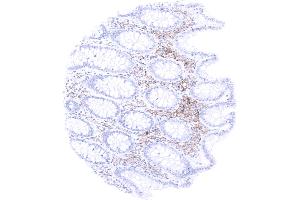 Colon descendens mucosa (Recombinant TIM3 antibody)