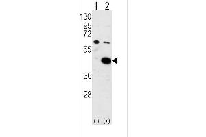 Western blot analysis of PDK2 (arrow) using PDK2 Antibody (C-term) (ABIN391037 and ABIN2841203). (PDK2 antibody  (C-Term))