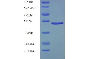 SDS-PAGE (SDS) image for Growth Arrest and DNA-Damage-Inducible, gamma (GADD45G) (AA 1-159), (full length) protein (His-SUMO Tag) (ABIN5709549)