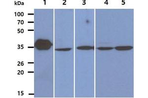 The Recombinant Human LDHB (50ng) and Cell lysates (40ug) were resolved by SDS-PAGE, transferred to PVDF membrane and probed with anti-human LDHB antibody (1:1000). (LDHB antibody)
