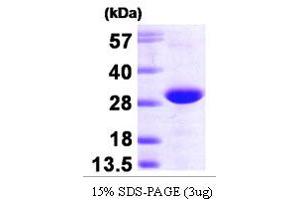 SDS-PAGE (SDS) image for Related RAS Viral (R-Ras) Oncogene Homolog 2 (RRAS2) (AA 1-201) protein (His tag) (ABIN666896)