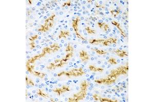 Immunohistochemistry of paraffin-embedded rat kidney using CCL22 antibody (ABIN5974972) at dilution of 1/100 (40x lens). (CCL22 antibody)